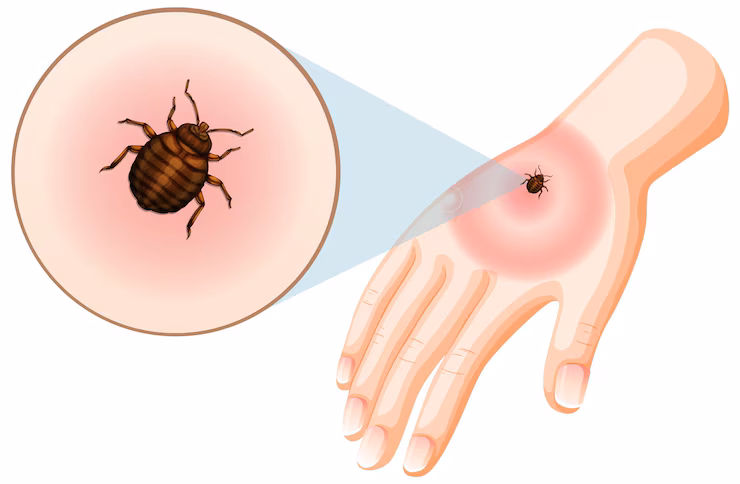 What Do Tick Bites Look Like
